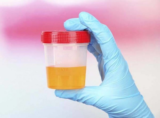 Tes kehamilan dengan urin