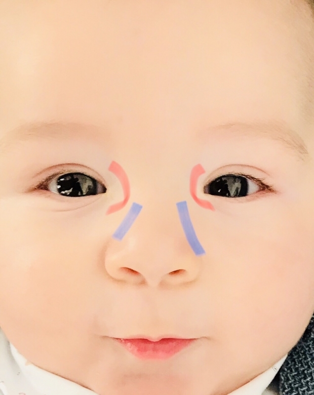 Pijat mata duri pada bayi