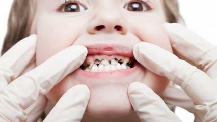 Selesaikan perawatan gigi anak Anda selama semester!