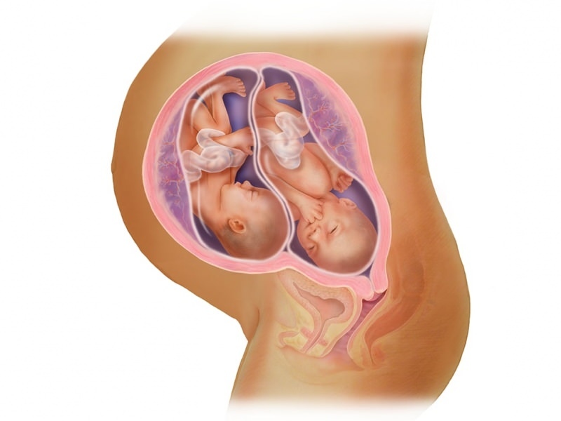 Kehamilan kembar di IVF! Apa itu transfer embrio?
