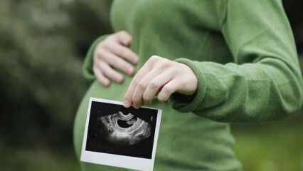 Kapan jenis kelamin bayi paling awal dan pasti? Siapa yang menentukan jenis kelamin?