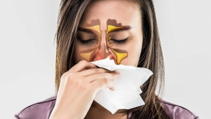 Apa itu alergi? Apa saja gejala rinitis alergi? Ada berapa jenis alergi? 