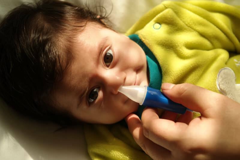 Bagaimana membersihkan hidung bayi tanpa sakit? Hidung tersumbat dan metode pembersihan pada bayi