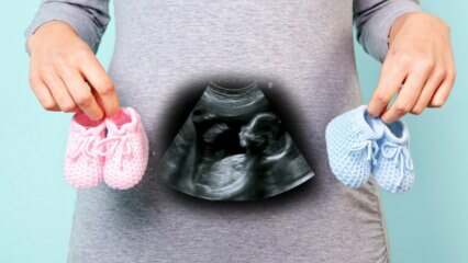 Akankah jenis kelamin bayi ditentukan pada trimester pertama kehamilan?