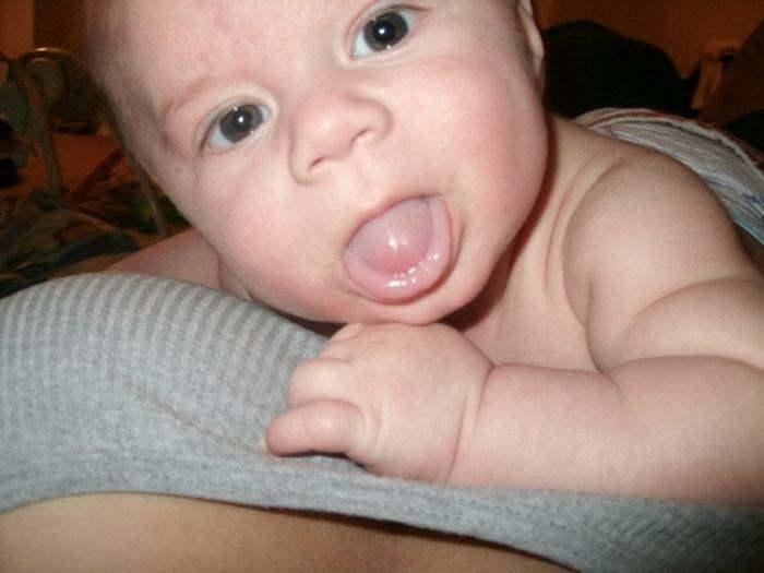 menjulurkan lidah pada bayi