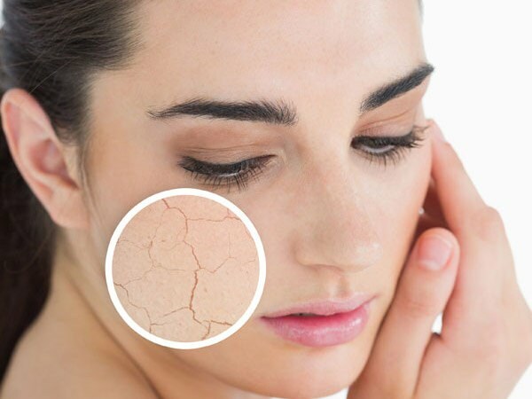 Mengapa kulitnya kering? Apa yang harus dilakukan pada kulit kering? Rekomendasi perawatan paling efektif untuk kulit kering
