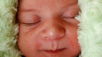 Mengapa titik-titik putih muncul pada bayi?