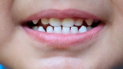Bagaimana cara mengajar anak-anak perawatan gigi?