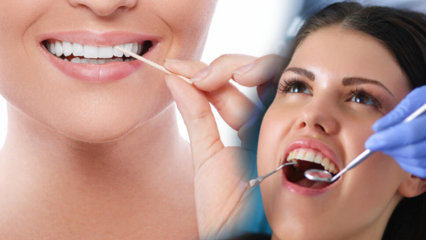 Bagaimana menjaga kesehatan gigi dan mulut? Apa yang harus diperhatikan saat membersihkan gigi?