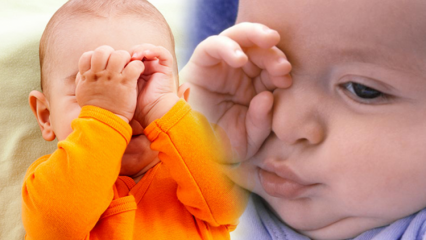 Solusi alami untuk membakar mata pada bayi