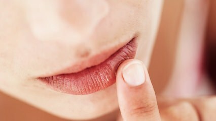 Bagaimana seharusnya perawatan bibir selama kehamilan?
