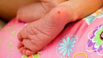 Mengapa darah tumit diambil pada bayi? Persyaratan untuk tes darah tumit pada bayi