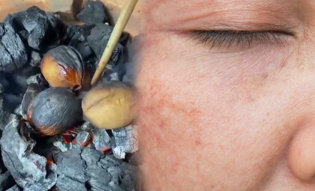 Campuran kenari-minyak zaitun yang menghilangkan noda dan bekas luka bakar di wajah hanya dengan satu pena!