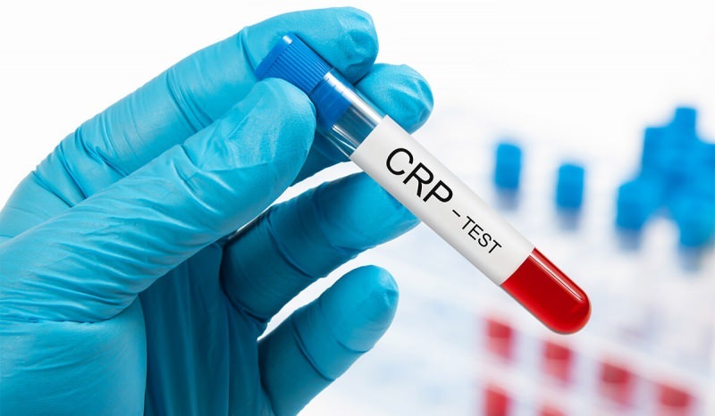 Mengapa CRP dalam darah naik? Apa itu CRP? Bagaimana cara menurunkan CRP?