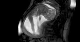 Gambar paling jelas dari bayi di dalam rahim ibu muncul!