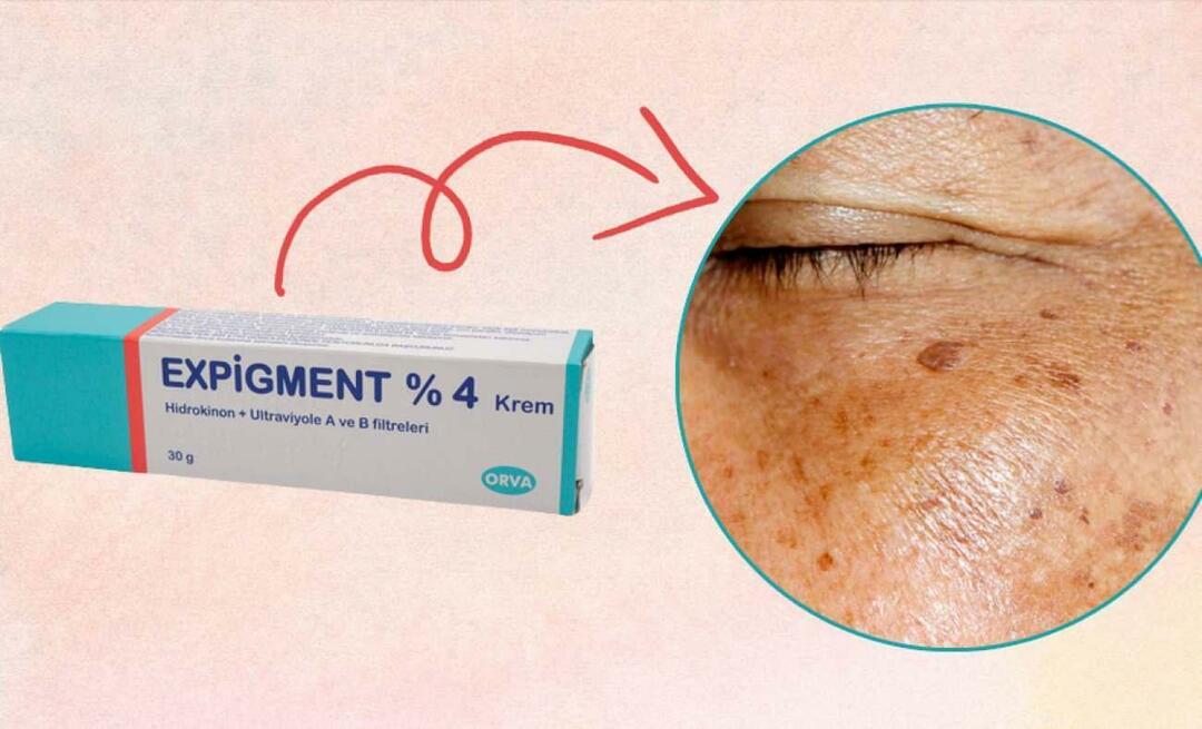 Apa yang dilakukan krim Expigment? Bagaimana cara menggunakan krim Expigment? Harga krim expigment 2023