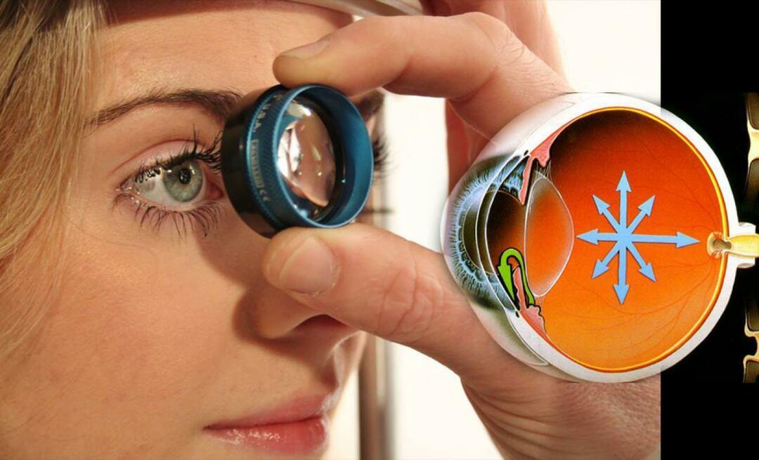 Apa itu glaukoma? Perhatikan penyakit ini yang berkembang secara diam-diam tanpa memberikan gejala apa pun!