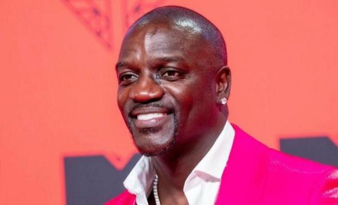 Penyanyi Amerika Akon juga lebih memilih Turki untuk transplantasi rambut! Inilah harga yang dia bayar...