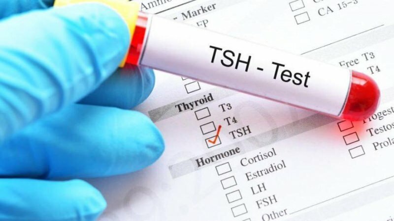 Apa tes TSH itu? Apa saja gejala TSH? Apa arti TSH tinggi dan rendah?