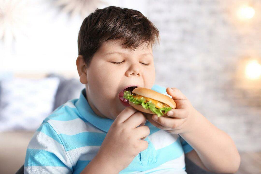 Apa itu obesitas pada anak
