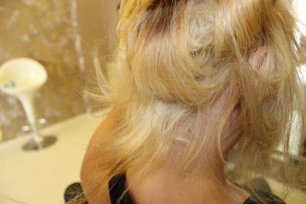 Apa yang dilakukan pada rambut yang terbakar dari tengah? Bagaimana seharusnya rambut yang dirawat dirawat?