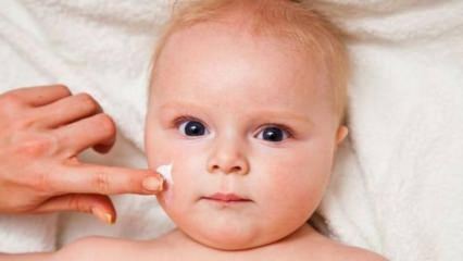 Kiat perawatan kulit untuk bayi! Apa masalah kulit pada bayi?