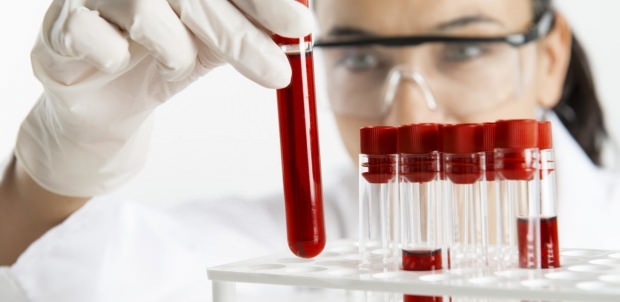 kadar hemoglabin diperiksa dengan tes darah