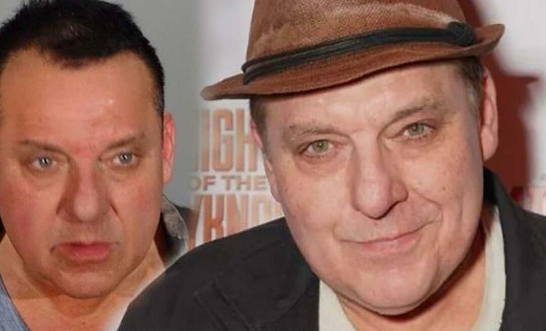 Tom Sizemore meninggal karena aneurisma otak!