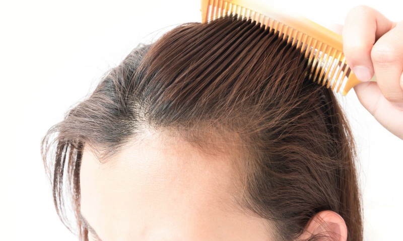 solusi rambut rontok setelah melahirkan! Apa yang baik untuk rambut rontok?
