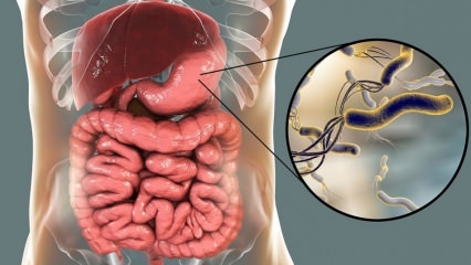 Apa itu Helicobacter Pylori (mikroba perut)? Penyakit yang disebabkan oleh Helicobacter Pylori ...