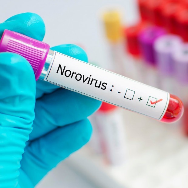 Apa itu norovirus dan apa penyebab penyakit