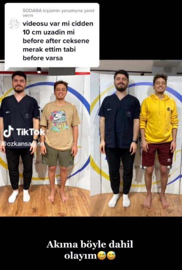 Özkan Sağın melakukannya sebelum dan sesudah operasi