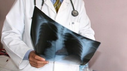 Para ahli diumumkan! Peningkatan kematian akibat kanker paru-paru