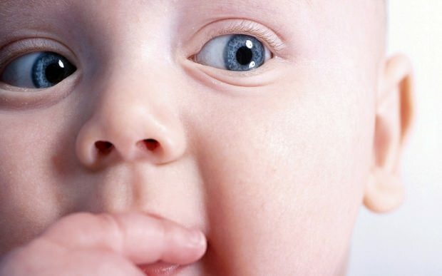 Mengapa mata bergeser pada bayi?
