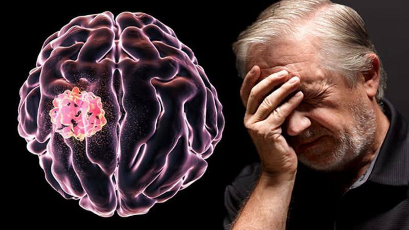 Jaringan yang terbentuk di otak akibat terganggunya struktur sel disebut tumor.