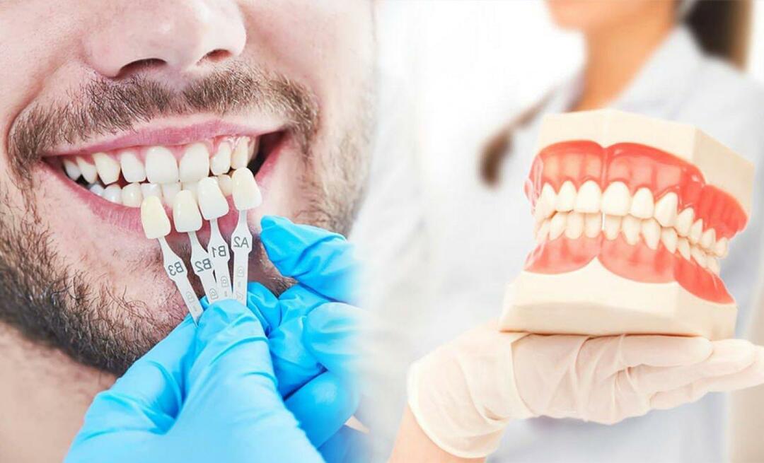 Mengapa lapisan zirkonium diterapkan pada gigi? Seberapa tahan lama lapisan zirkonium?