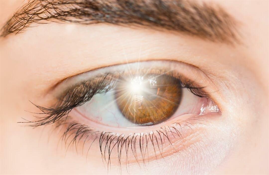 Apa yang menyebabkan kilatan cahaya di mata dan bagaimana pengobatannya?