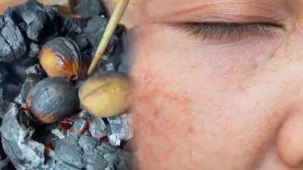 Campuran kenari-minyak zaitun yang menghilangkan noda dan bekas luka bakar di wajah!