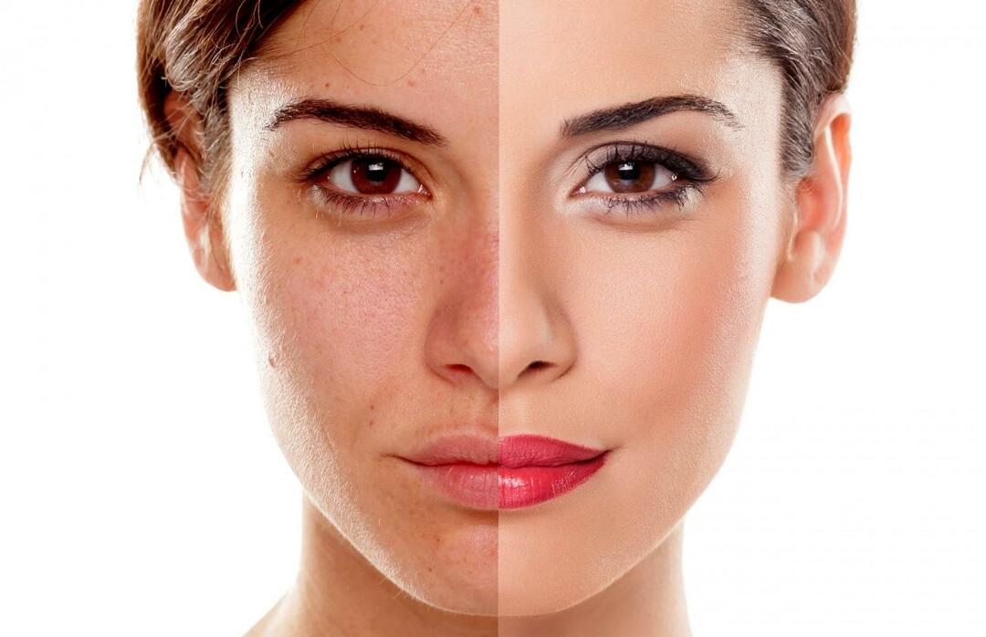 Bagaimana kita mencegah kulit terlihat lelah? Bagaimana cara mengurangi tampilan kulit lelah?