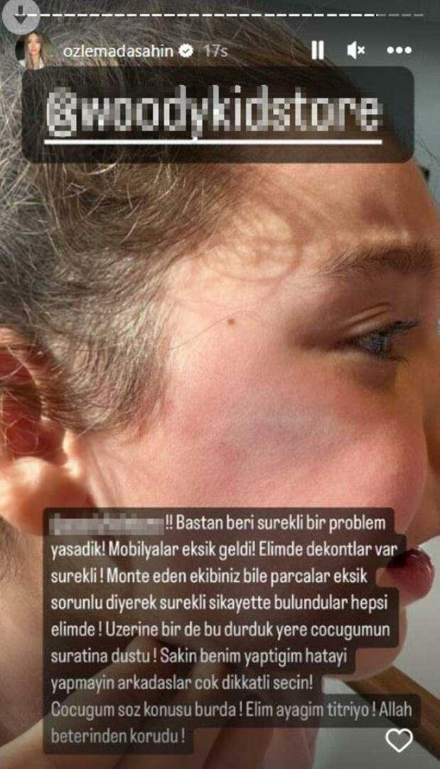 Pintu lemari jatuh di wajah putri Berkay Şahin