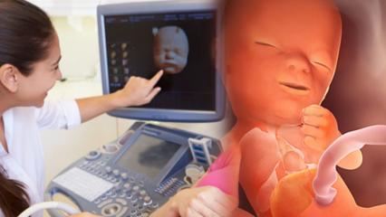 Organ mana yang pertama kali berkembang pada bayi? Perkembangan bayi minggu demi minggu