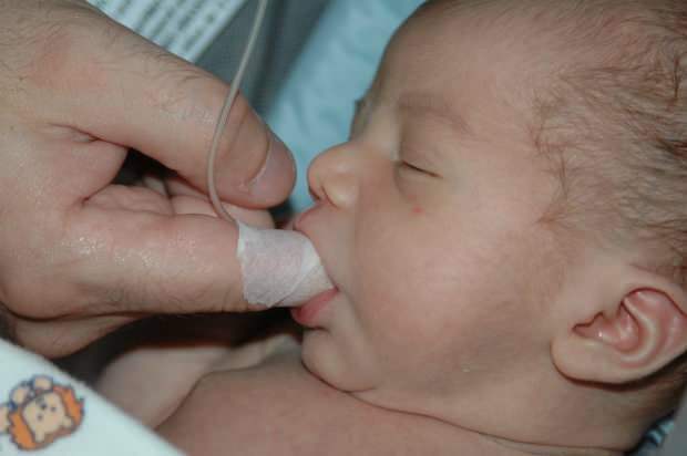 Apa metode Makan Jari? Bagaimana memberi makan bayi dengan jarum suntik?
