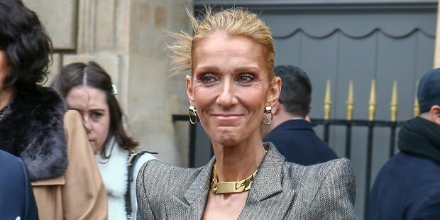 Celine Dion melemah