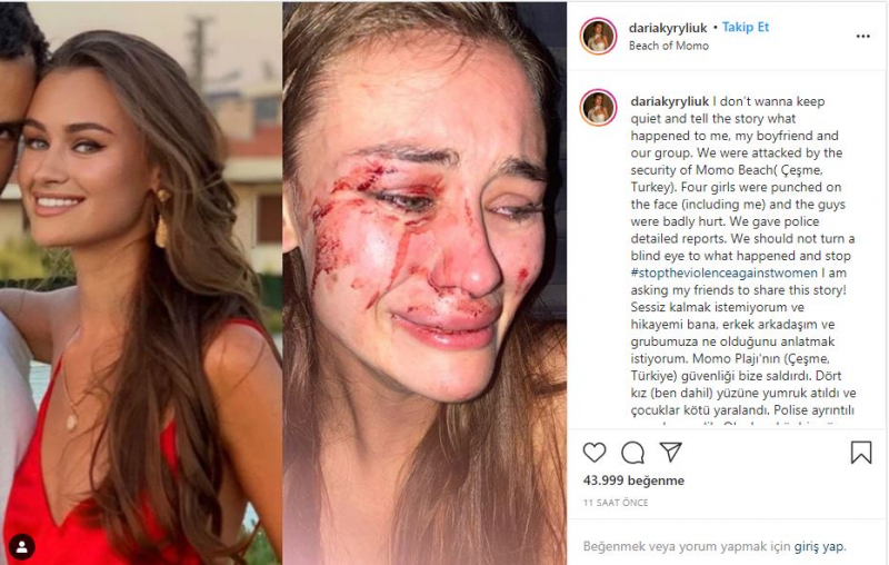 Model top Ukraina Daria Kyryliuk, yang diduga dipukuli di İzmir Çeşme, berbicara untuk pertama kalinya!
