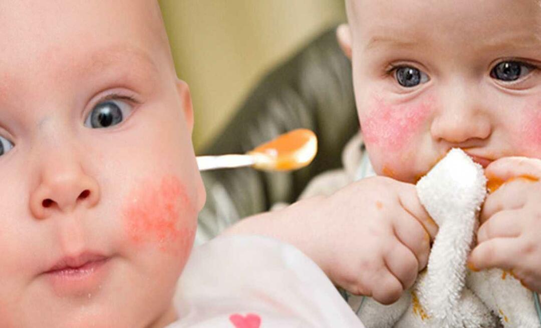 Apa yang harus dimakan bayi dengan alergi? Apa makanan alternatif untuk bayi alergi?